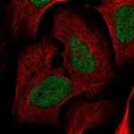 Nardilysin Antibody in Immunocytochemistry (ICC/IF)