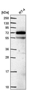 EEPD1 Antibody in Western Blot (WB)