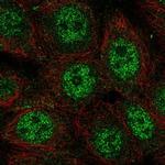 WDYHV1 Antibody in Immunocytochemistry (ICC/IF)