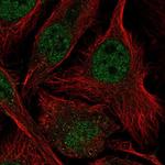 ASF1B Antibody in Immunocytochemistry (ICC/IF)