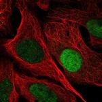 UPP1 Antibody in Immunocytochemistry (ICC/IF)