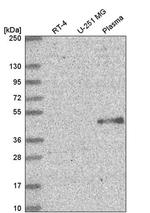 ELOVL5 Antibody in Western Blot (WB)