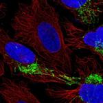 CPOX Antibody in Immunocytochemistry (ICC/IF)