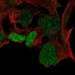 SOX3 Antibody in Immunocytochemistry (ICC/IF)