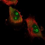 ATXN7L2 Antibody in Immunocytochemistry (ICC/IF)