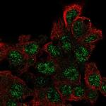 C17orf96 Antibody in Immunocytochemistry (ICC/IF)