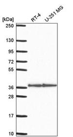 STX12 Antibody in Western Blot (WB)