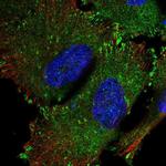 SRP68 Antibody in Immunocytochemistry (ICC/IF)