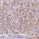 GOLPH3 Antibody in Immunohistochemistry (IHC)