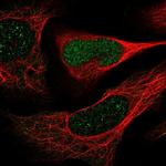 DERA Antibody in Immunocytochemistry (ICC/IF)