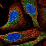 HM13 Antibody in Immunocytochemistry (ICC/IF)