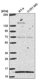 GTF2A2 Antibody in Western Blot (WB)