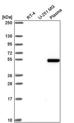 ZGPAT Antibody in Western Blot (WB)