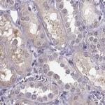 PKP2 Antibody in Immunohistochemistry (IHC)