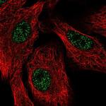 SETX Antibody in Immunocytochemistry (ICC/IF)