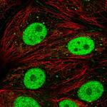 DCP2 Antibody in Immunocytochemistry (ICC/IF)