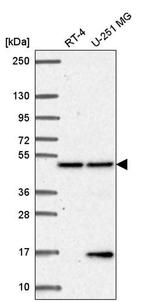 PCBP4 Antibody in Western Blot (WB)