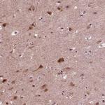 NAP1L5 Antibody in Immunohistochemistry (IHC)