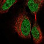 COL9A3 Antibody in Immunocytochemistry (ICC/IF)