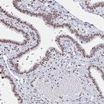 UAP56 Antibody in Immunohistochemistry (IHC)