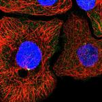 KIF6 Antibody in Immunocytochemistry (ICC/IF)