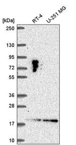 LLPH Antibody in Western Blot (WB)