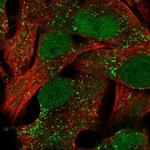 ACSBG1 Antibody in Immunocytochemistry (ICC/IF)