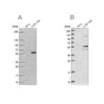 ACSBG1 Antibody in Western Blot (WB)