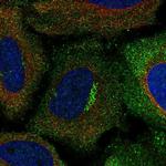 ASIC1 Antibody in Immunocytochemistry (ICC/IF)