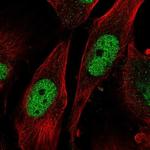 SAP30 Antibody in Immunocytochemistry (ICC/IF)