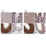 GSS Antibody in Immunohistochemistry (IHC)