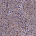 GSS Antibody in Immunohistochemistry (IHC)