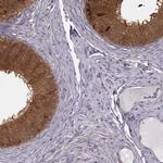 GSS Antibody in Immunohistochemistry (IHC)