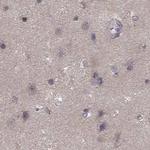 GSS Antibody in Immunohistochemistry (IHC)