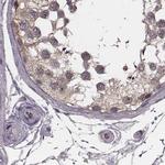 GSS Antibody in Immunohistochemistry (IHC)