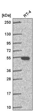 GSS Antibody in Western Blot (WB)