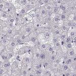 GRK1 Antibody in Immunohistochemistry (IHC)