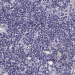 GRK1 Antibody in Immunohistochemistry (IHC)