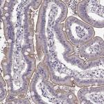 GRK1 Antibody in Immunohistochemistry (IHC)