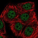 SETD1B Antibody in Immunocytochemistry (ICC/IF)