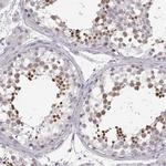 OIP5 Antibody in Immunohistochemistry (IHC)