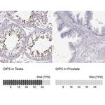 OIP5 Antibody