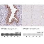 GRHL3 Antibody in Immunohistochemistry (IHC)