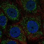 ZNHIT3 Antibody in Immunocytochemistry (ICC/IF)