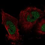 IER2 Antibody in Immunocytochemistry (ICC/IF)