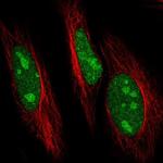 UBC3B Antibody in Immunocytochemistry (ICC/IF)