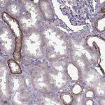 CCDC64 Antibody in Immunohistochemistry (IHC)