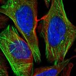 CSGALNACT1 Antibody in Immunocytochemistry (ICC/IF)