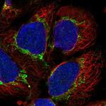 AARS2 Antibody in Immunocytochemistry (ICC/IF)