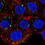 PIGQ Antibody in Immunocytochemistry (ICC/IF)